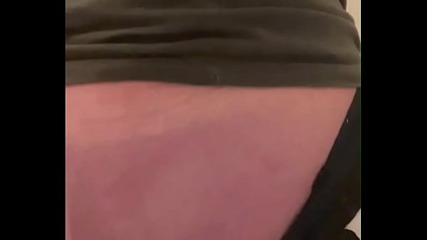 Prolapso anal – Vídeo de verificação